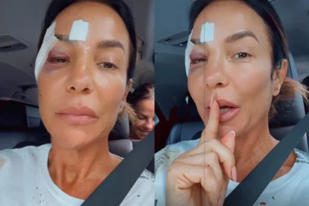 Ivete Sangalo agora fala sobre saúde após internação Ivete Sangalo agora fala sobre saúde após internação